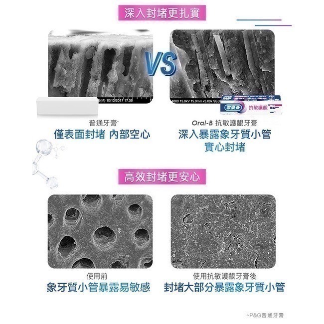 Oral-B/歐樂-B 牙膏 抗敏護齦-極速抗敏-細節圖6