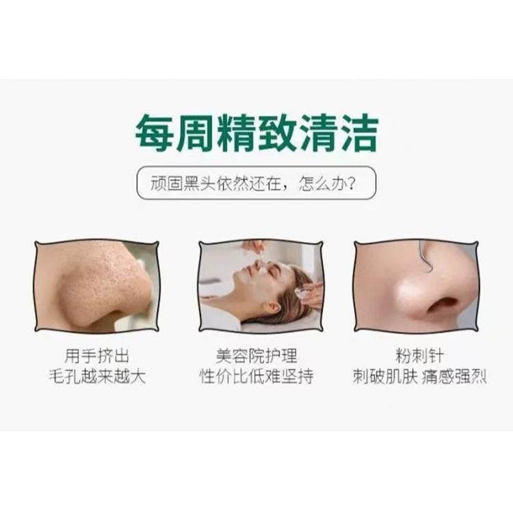 黑頭粉刺鏟 黑頭鏟 粉刺鏟 人體工學去黑頭鏟 粉刺棒 黑頭 粉刺 去黑頭 去粉刺 鼻頭粉刺 臉部清潔工具 刮 台灣現貨-細節圖3