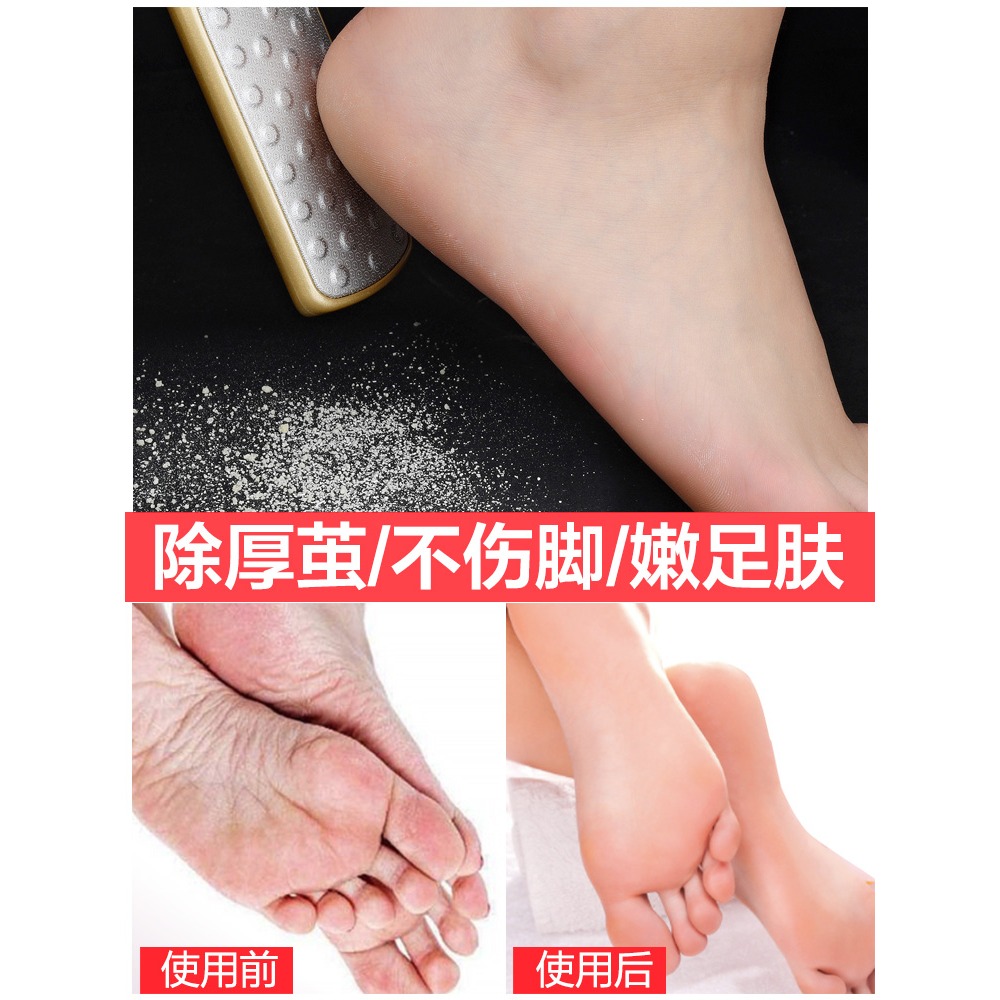磨腳神器去死皮腳工具搓腳板磨皮磨腳石挫腳底刮腳刀修腳底腳後跟-細節圖3