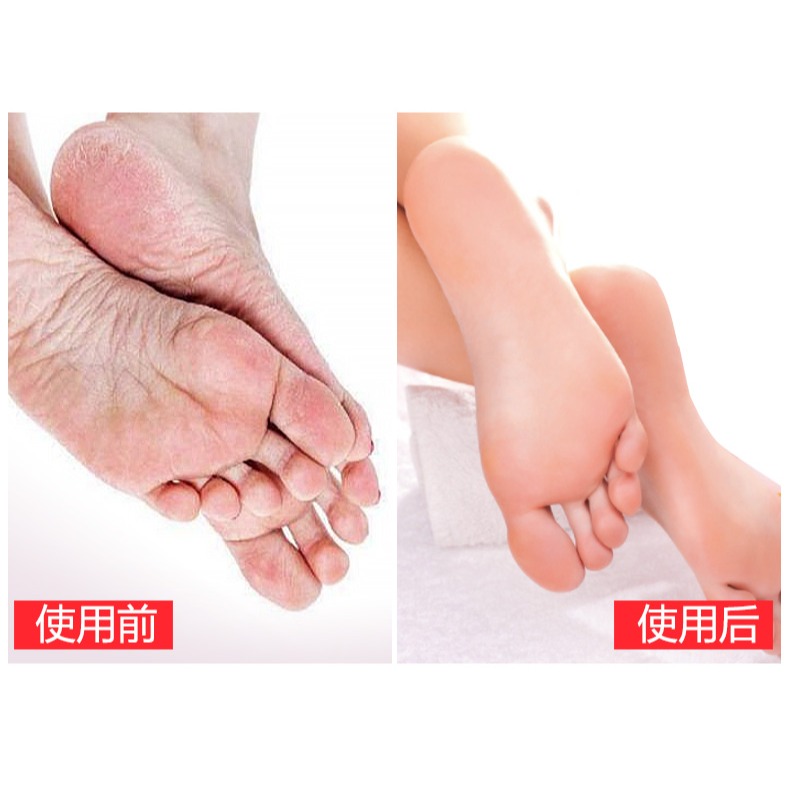 磨腳神器去死皮腳工具搓腳板磨皮磨腳石挫腳底刮腳刀修腳底腳後跟-細節圖8