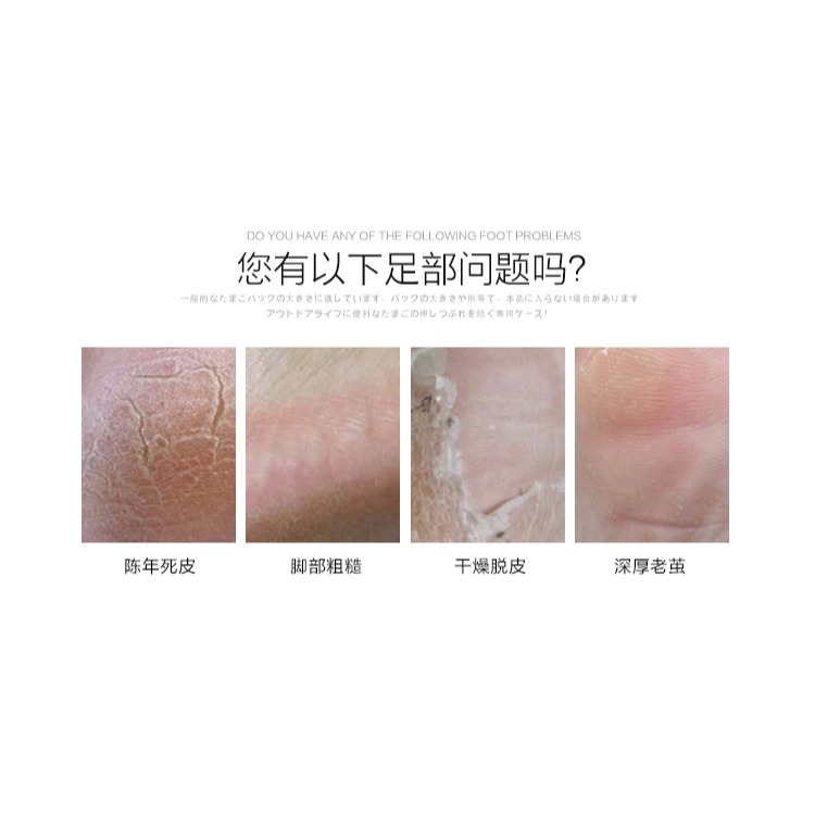 磨腳神器死皮刀刮腳後跟去腳皮器搓腳板足部祛磨挫戳銼磨皮石-細節圖9