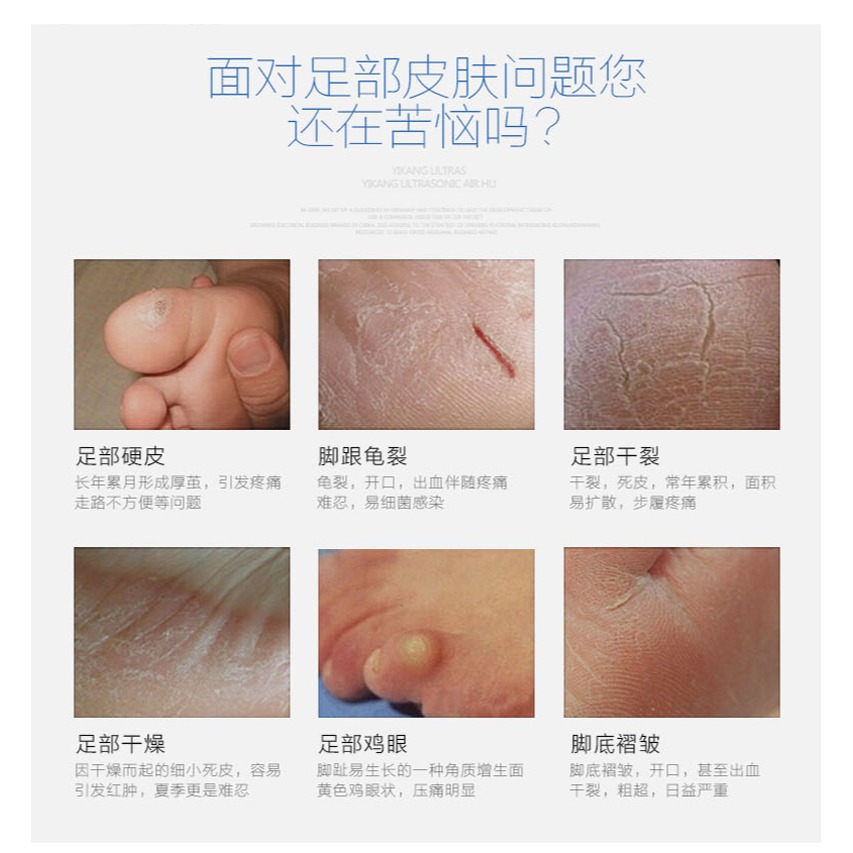 進口磨腳器去死皮老繭磨腳石修腳工具腳底去腳皮不銹鋼搓腳板-細節圖10
