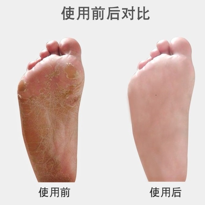搓腳板神器洗腳上擦老繭刷挫手足去死皮器角質修戳腳步木質-細節圖4