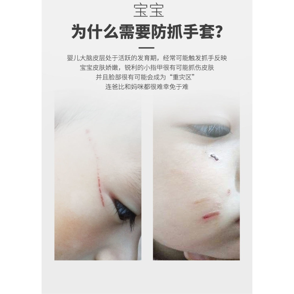 嬰兒手套防抓臉神器可咬薄款純棉新生兒寶寶防抓護手夏季睡覺腳套-細節圖8