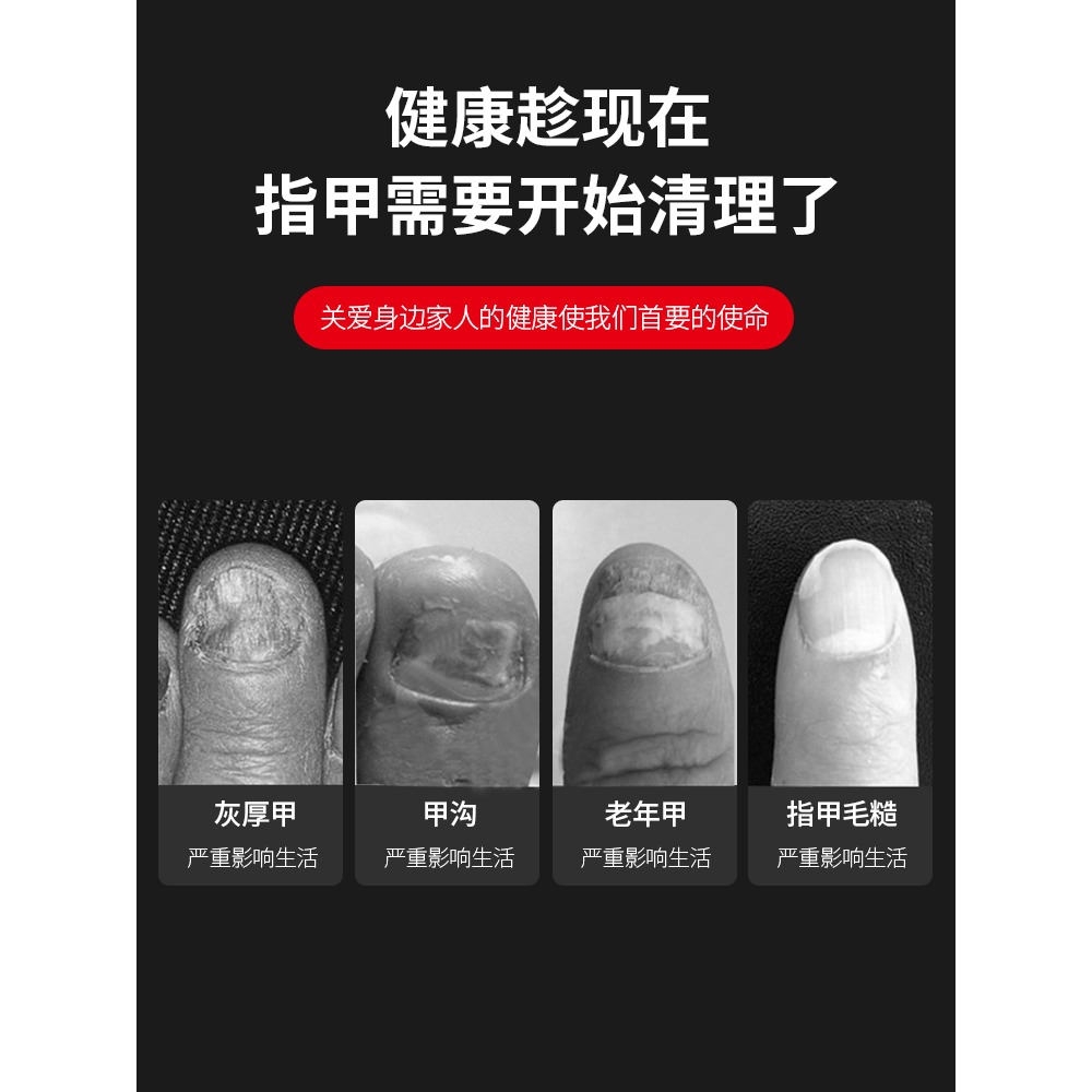 指甲銼打磨條不銹鋼修磨厚硬腳趾甲老人灰甲銼修甲挫刀磨甲器鋼銼-細節圖4