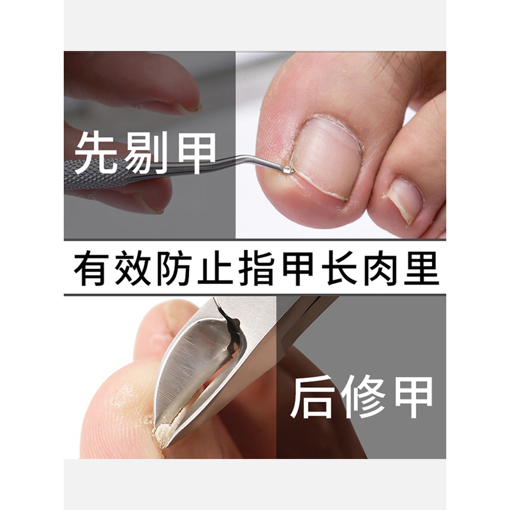 甲溝專用剔甲器炎甲溝勺修腳神器腳趾甲縫嵌甲工具裝不銹鋼剃甲器-細節圖2