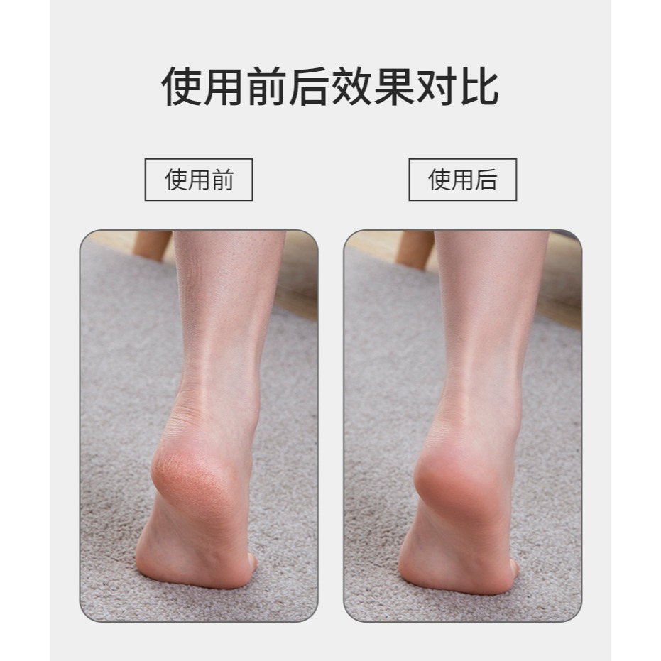 搓腳磨腳器石去死皮老繭腳後跟乾裂角質雙面磨砂磨腳神器工具腳底-細節圖10