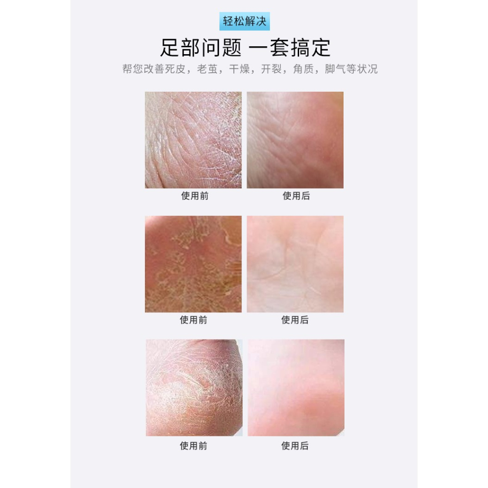 美腳修腳刀美足專業老皮修腳器套裝死皮刀刮腳神器去腳皮去死搓板-細節圖9