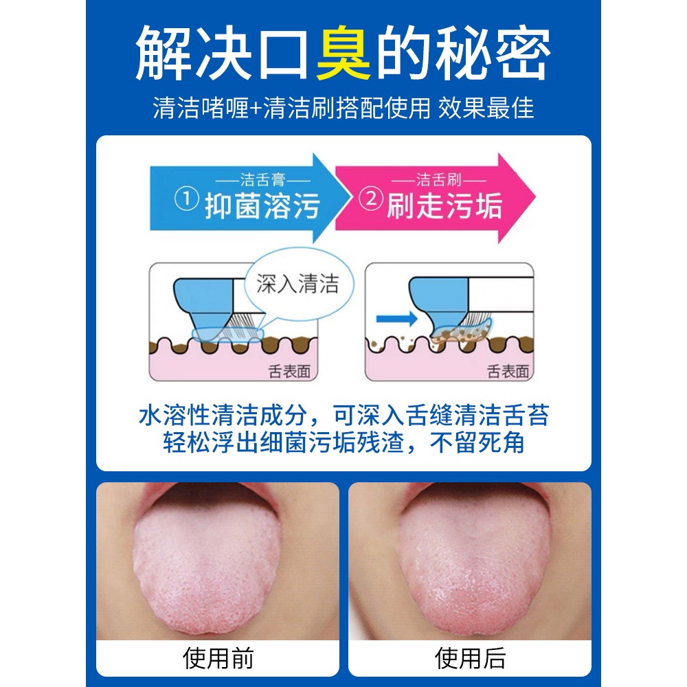 舌苔清潔?喱牙膏去異味刮舌苔清潔器男士女刷舌頭去口臭清理神器-細節圖2
