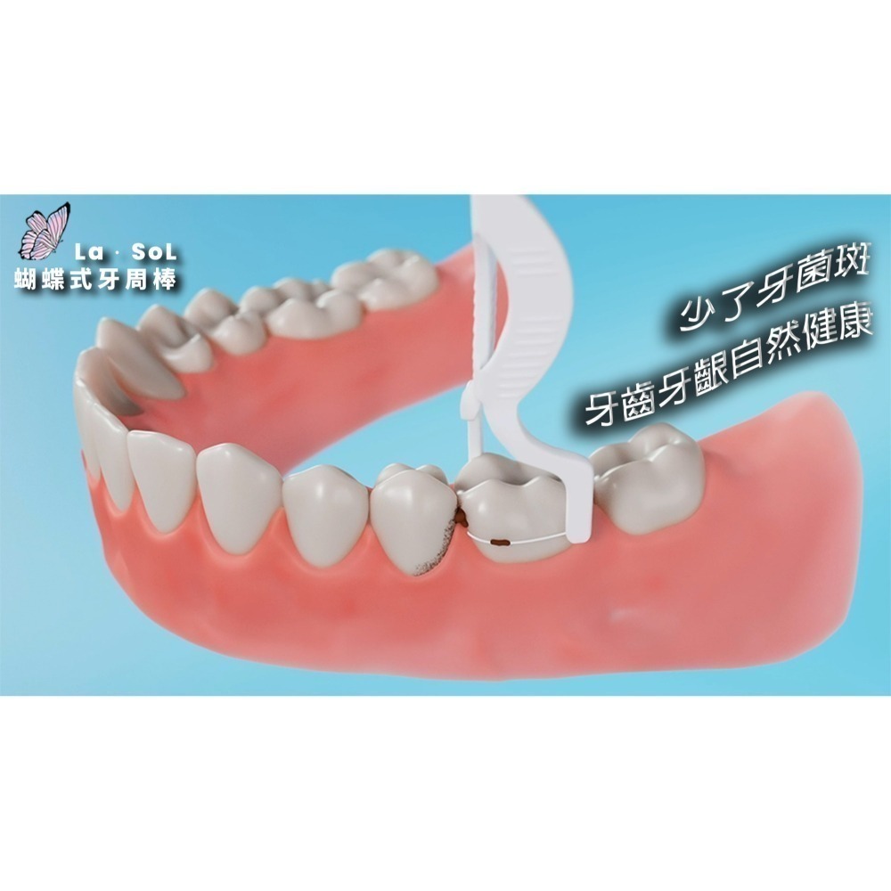 La．SoL蝴蝶式牙周棒-細節圖3