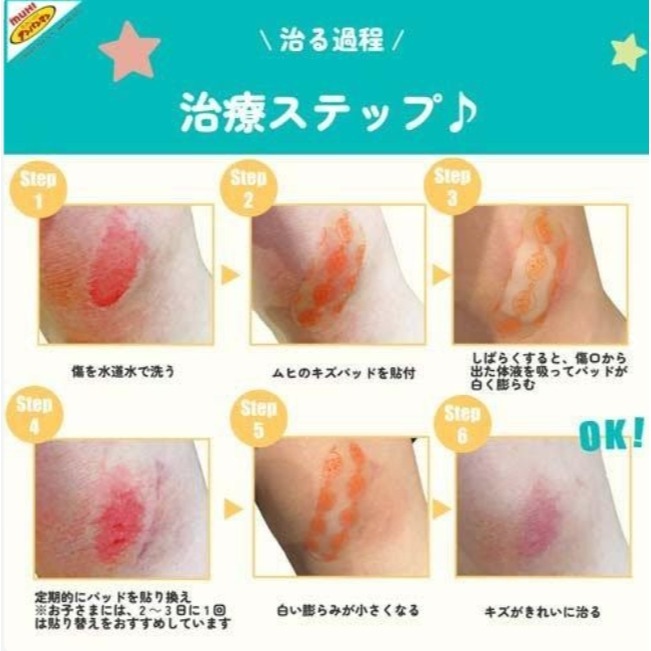 池田模範堂 MUHI 兒童自愈力加強型OK繃 10枚入 3歲起可用-細節圖2