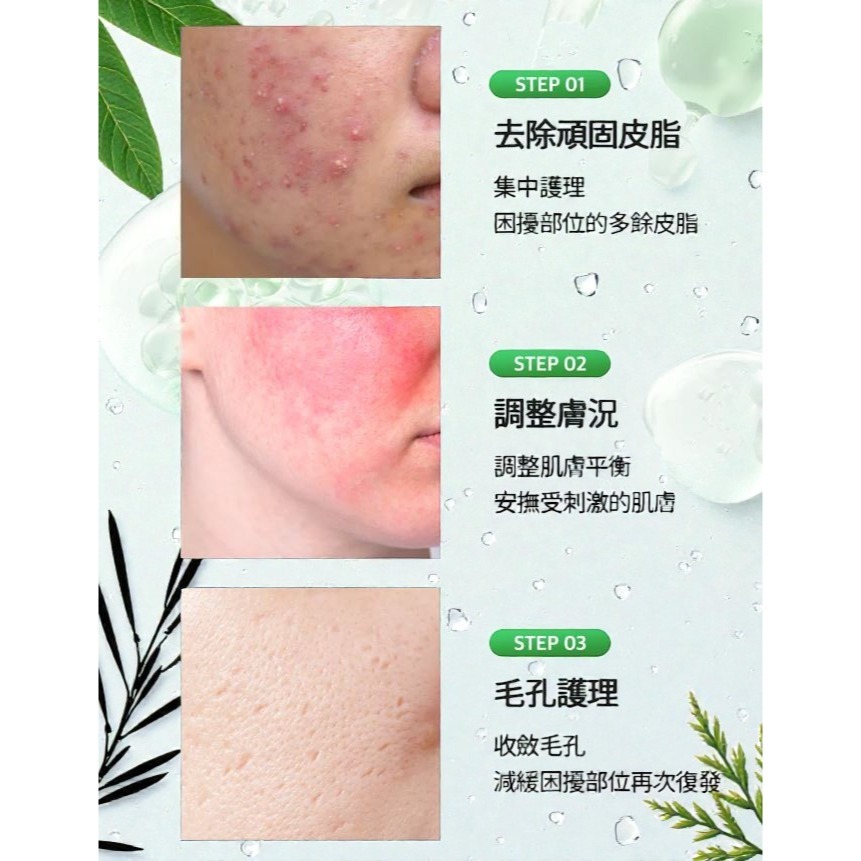 【SLLIGHT】現貨速出💖積雪草乳酸菌舒緩凝膠15g🤍-細節圖4