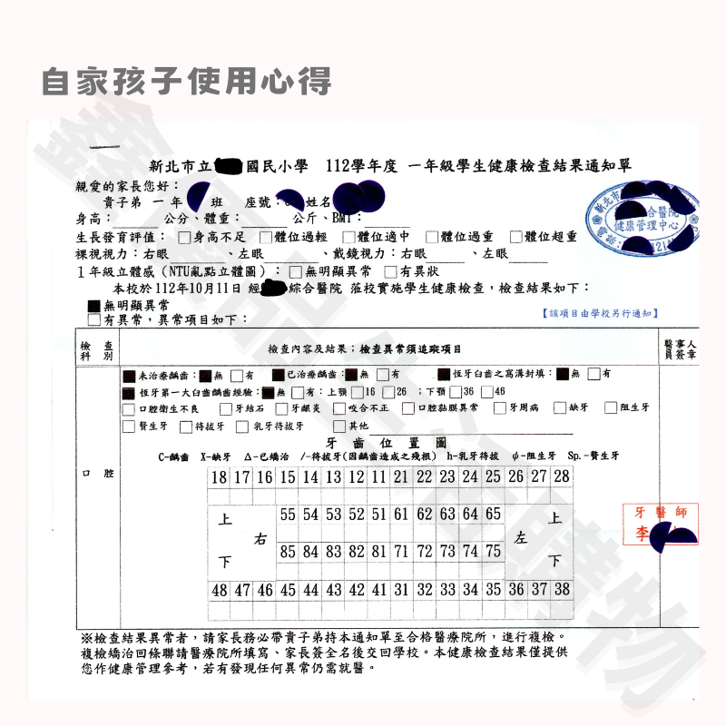 優立淨 youlijing 兒童電動牙刷 音波電動牙刷 兒童牙刷-細節圖3