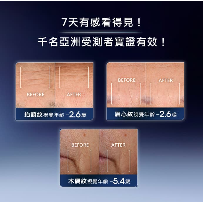 全新升級版✨ 蘭蔻 超極限肌因賦活露 50ml 小黑瓶 PRO-細節圖4