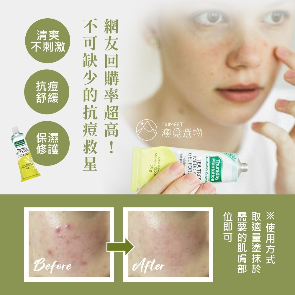 星期四農莊 茶樹抗痘凝膠-細節圖2
