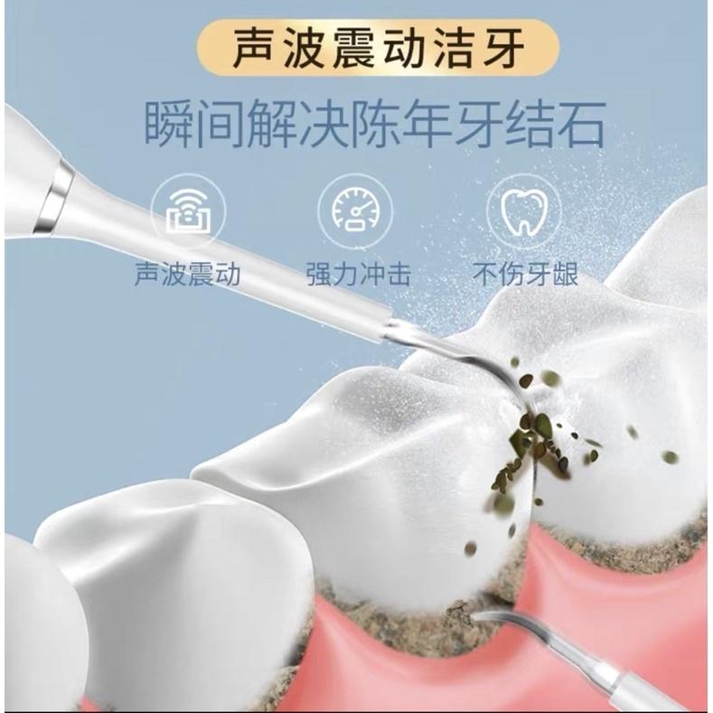 [BJ商城］台灣現貨 🇹🇼 電動牙刷情侶防水超聲波震動牙縫殘渣男女家用清潔去除牙結石神器-細節圖4