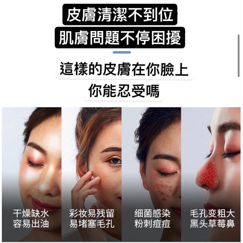 [BJ商城］🇹🇼 最新款換膚神器超微小氣泡家用美容儀器毛孔清潔器祛蟎蟲電動吸黑頭神器-細節圖2
