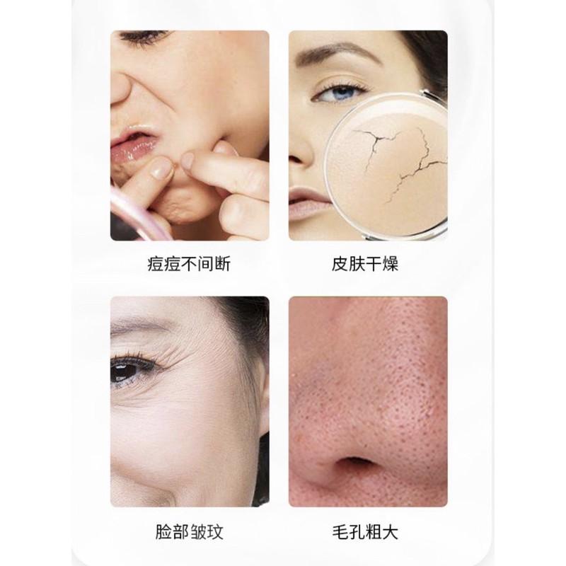 ［BJ商城］台灣現貨🇹🇼 彩光導入儀臉部按摩清潔導出儀器電子美容儀冷熱導入-細節圖4