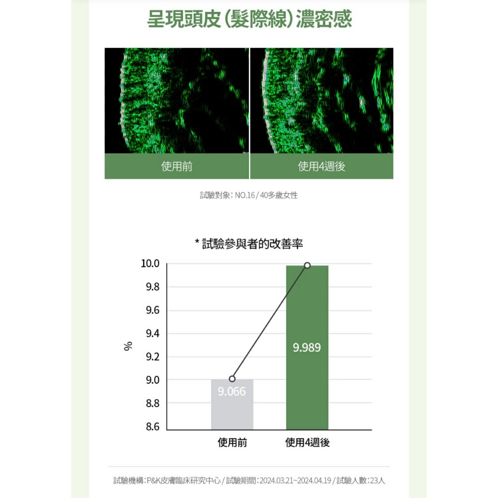 🌿艾多美 ATOMY 咖啡因養髮 原萃頭皮養護安瓶  3瓶一組 送一隻按摩氣墊梳子-細節圖2