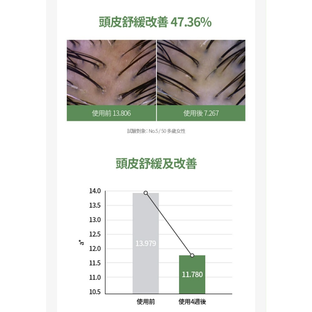 🌿艾多美 ATOMY 咖啡因養髮 原萃頭皮養護安瓶  3瓶一組 送一隻按摩氣墊梳子-細節圖3