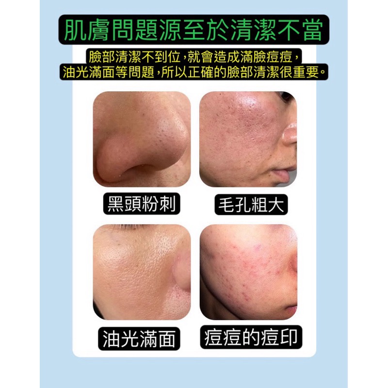 積雪草泡泡面膜 深層清潔 去除黑頭粉刺 收縮毛孔 生產效期新 清潔毛孔 泡泡面膜-細節圖4