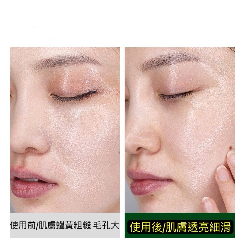 積雪草泡泡面膜 深層清潔 去除黑頭粉刺 收縮毛孔 生產效期新 清潔毛孔 泡泡面膜-細節圖5