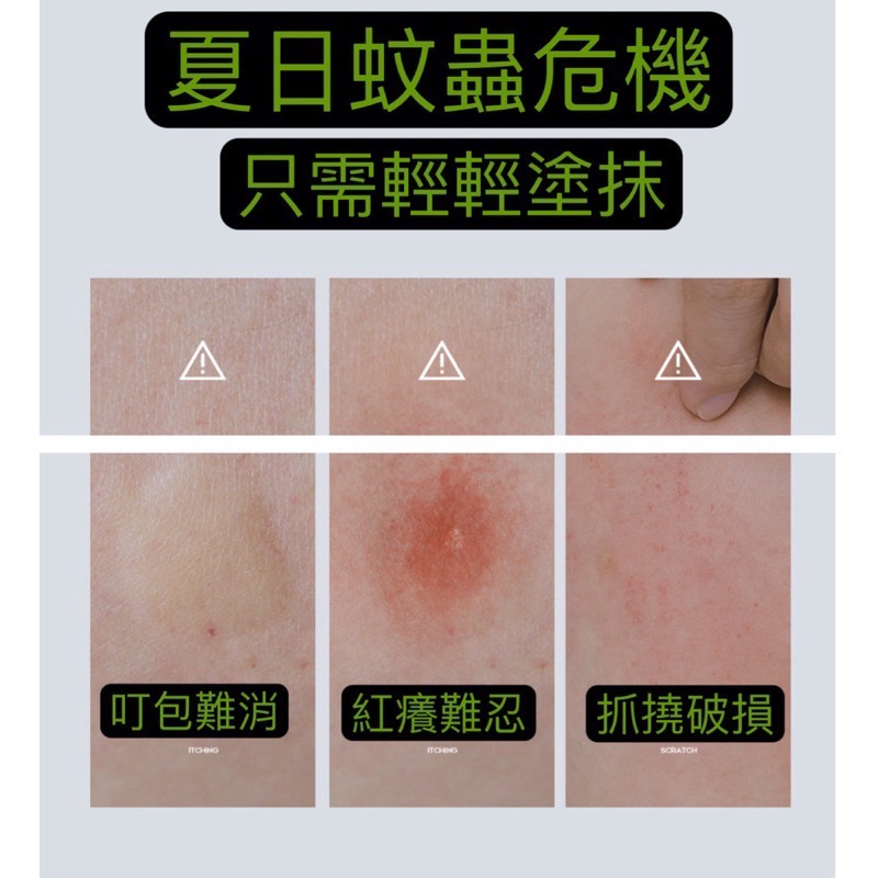 NAXR紫草舒爽膏 紫草膏 叮叮棒 舒癢膏 紫草棒 止癢棒 舒緩膏 蚊蟲叮咬 驅蚊膏-細節圖2