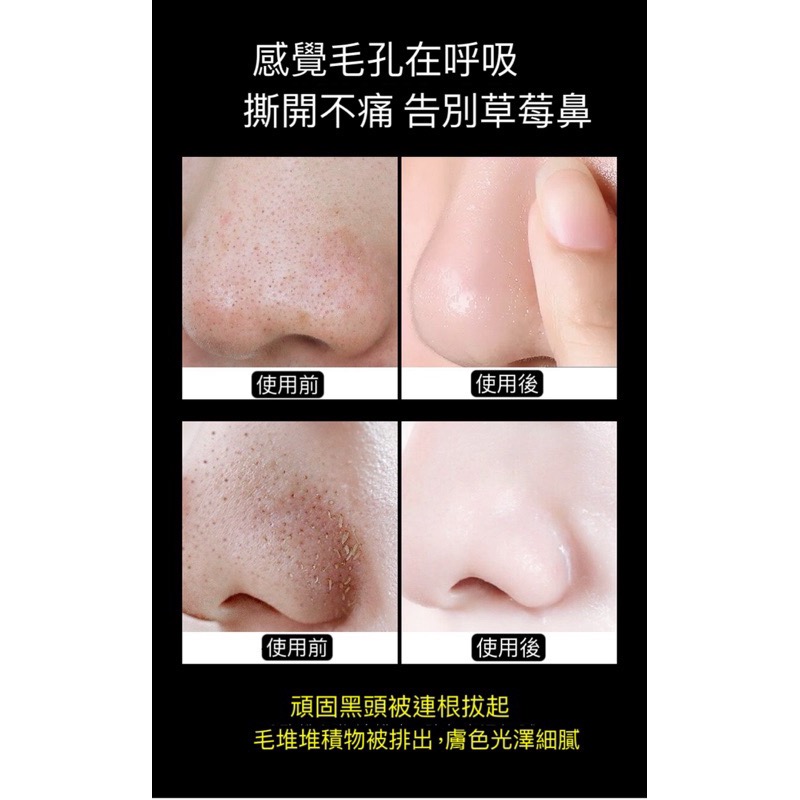 黑頭粉刺鼻膜膏 面膜 粉刺調理 撕拉鼻膜 去粉刺 收縮毛孔-細節圖4