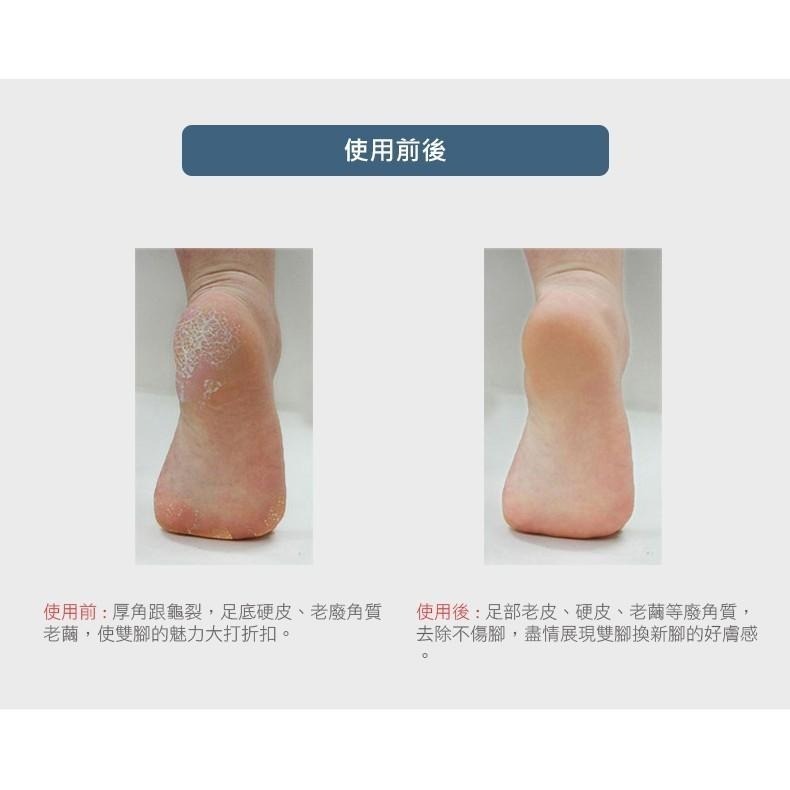 美甲 韓國 足磨棒 鎳足磨棒 金屬磨棒 足挫  磨腳器 腳皮刷 修腳皮 死皮挫 磨腳皮器 去角質 去死皮 磨腳棒 ~爾凱-細節圖6