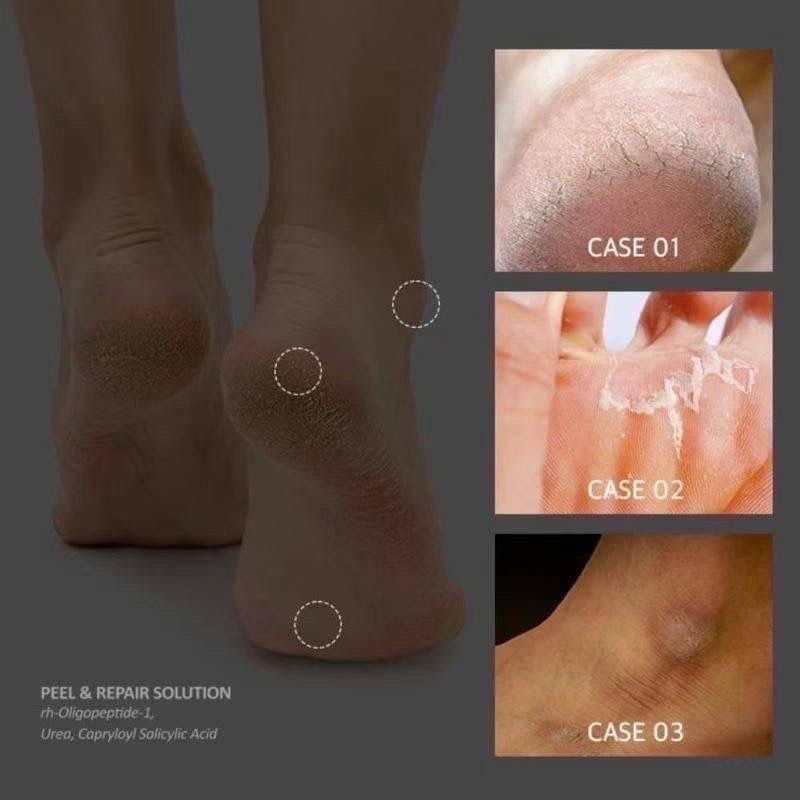 【現貨在台｜韓國】MEDI-PEEL美蒂菲 EGF寶寶肌保濕足霜130g-細節圖7