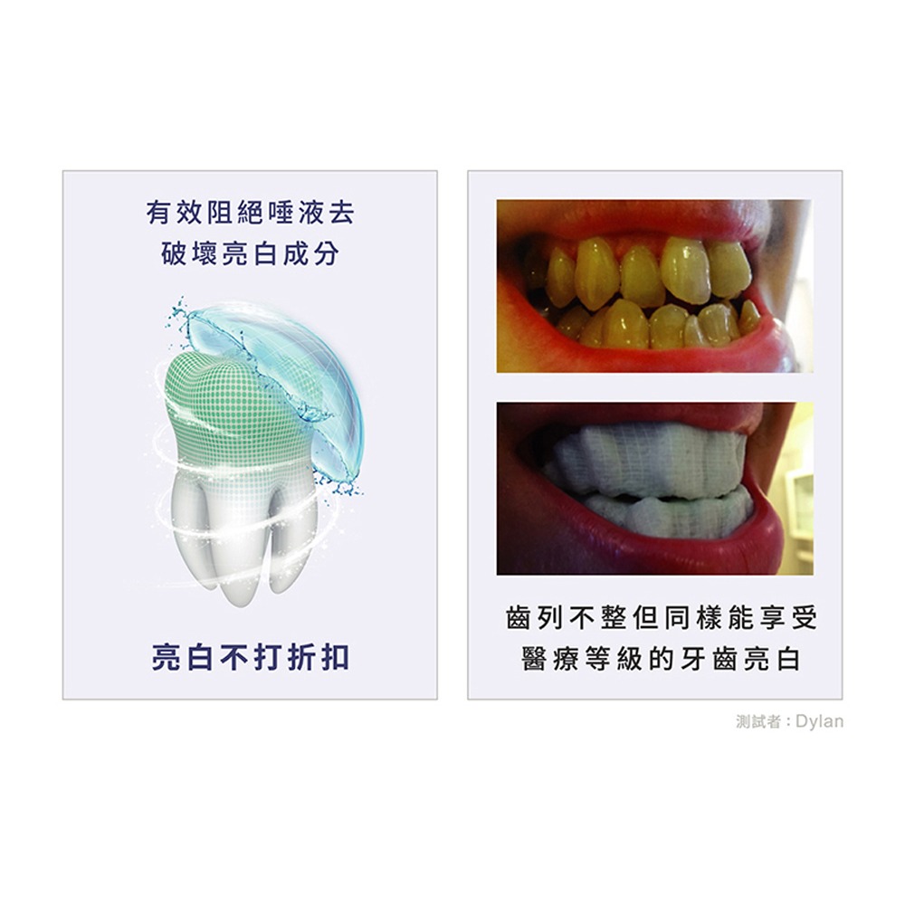 Protis 普麗斯 3D藍鑽牙托式深層長效牙齒美白組-歐盟新配方 5-7天 2入組-細節圖7