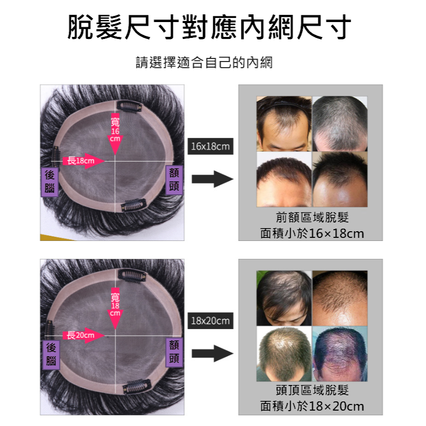 男 頭頂補髮片 假髮片 真人髮-飛機頭 韓版 透氣無痕 全手織 仿真頭皮 大面積補髮 禿頂 掉髮【黑二髮品】 OTYJ-細節圖10