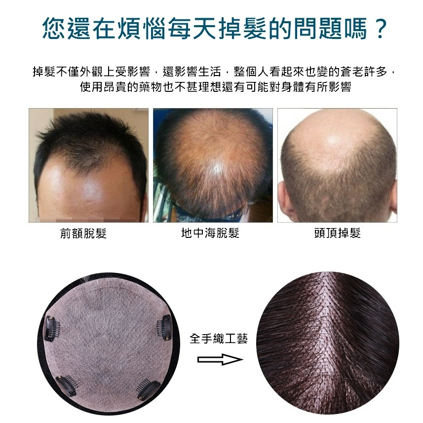 真髮 頭頂髮片 男 假髮片 假髮 補髮塊 - 日系髮型 頭頂補髮 微卷碎瀏海(2種內網) 【黑二髮品】OTYZ1-細節圖6