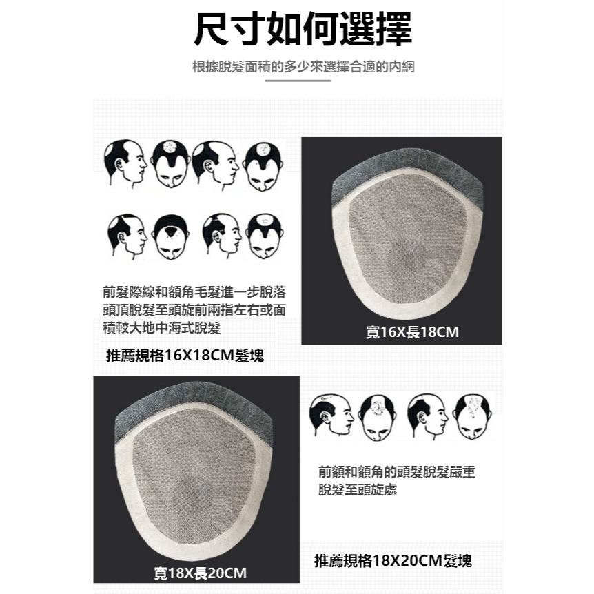 貼片式假髮 男 真髮髮片 頭頂髮片- 前額生物頭皮 假髮片 逼真自然 雄性禿【黑二髮品】 OXD-細節圖7