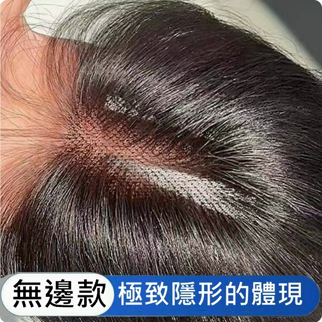 頭頂髮片 女生假髮片 頭頂前額補髮 全真髮- 手織內網 蓬鬆自然 透氣舒適【黑二髮品 】OYN-細節圖2