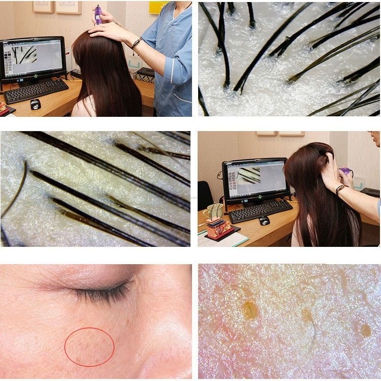 無線wifi 頭皮頭髮毛囊檢測儀 皮膚毛髮測試儀器 理髮店高清放大器-細節圖8