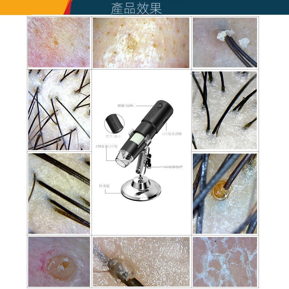 無線wifi 頭皮頭髮毛囊檢測儀 皮膚毛髮測試儀器 理髮店高清放大器-細節圖9