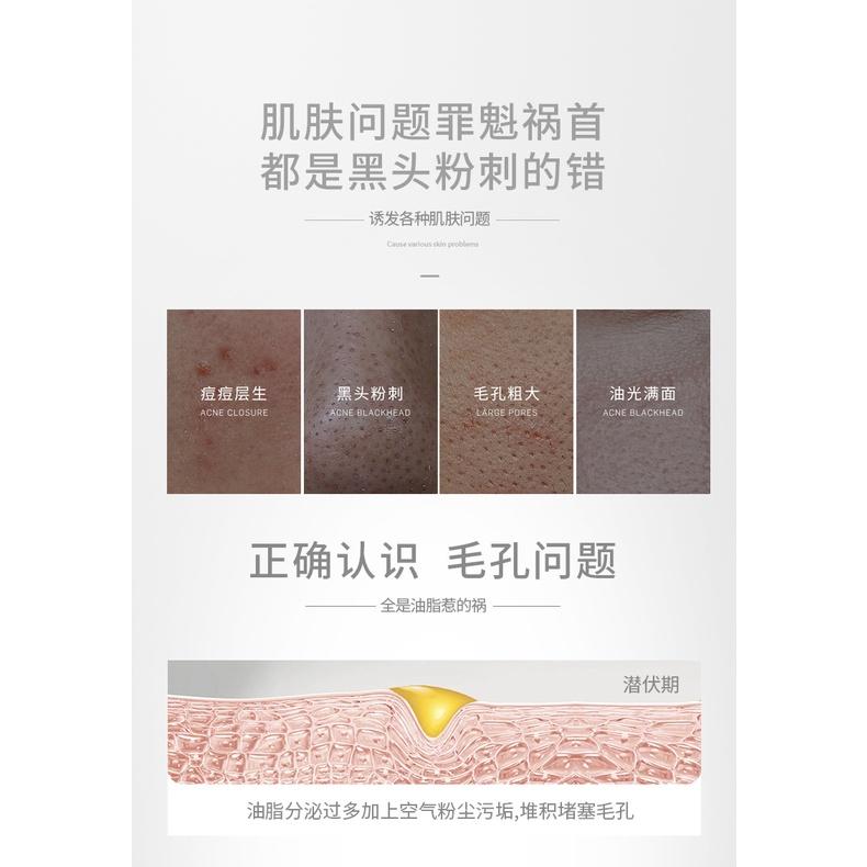 黑頭剋星 輕鬆去黑頭 童兮撕拉麵膜 撕拉面膜 黑竹炭淨膚蛋蛋面紗霜 黑頭拉撕面膜 T區護理 除粉刺黑頭 清潔鼻膜-細節圖5