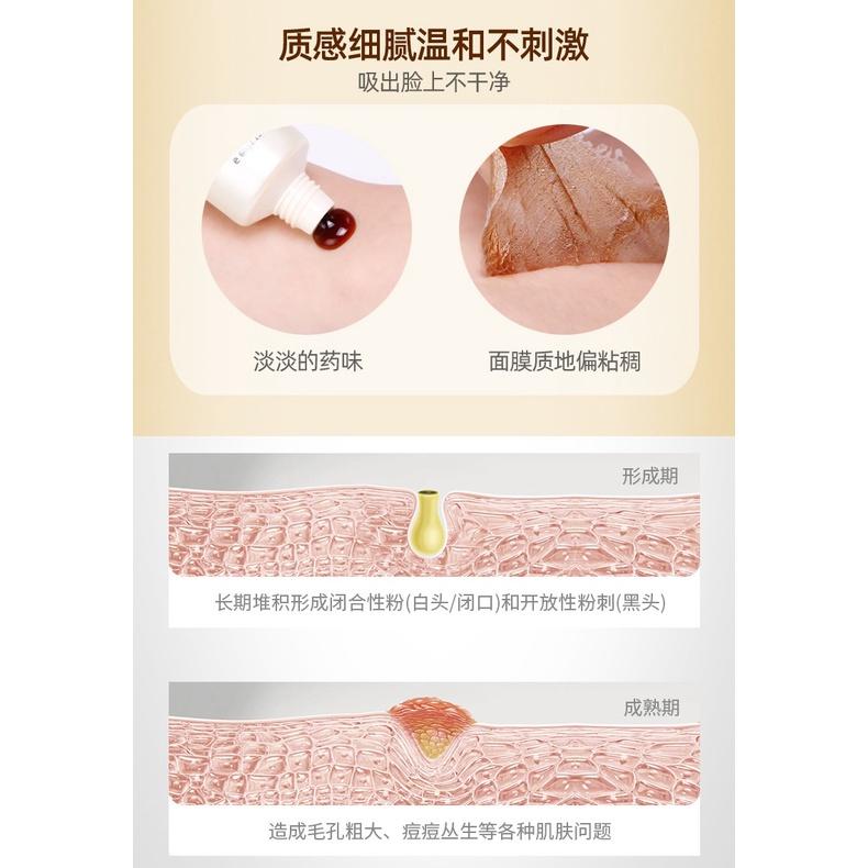 黑頭剋星 輕鬆去黑頭 童兮撕拉麵膜 撕拉面膜 黑竹炭淨膚蛋蛋面紗霜 黑頭拉撕面膜 T區護理 除粉刺黑頭 清潔鼻膜-細節圖6