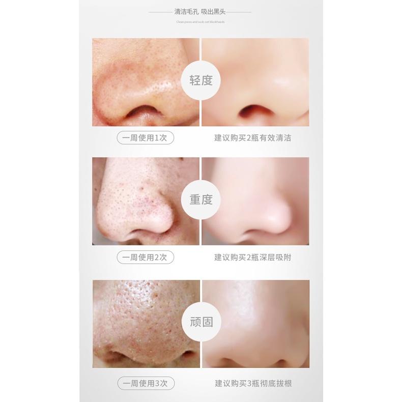 黑頭剋星 輕鬆去黑頭 童兮撕拉麵膜 撕拉面膜 黑竹炭淨膚蛋蛋面紗霜 黑頭拉撕面膜 T區護理 除粉刺黑頭 清潔鼻膜-細節圖8