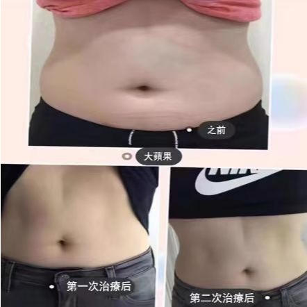 【美容儀器】 爆脂儀器 體雕儀器 甩脂機 腹肌訓練器 健腹機 腹部訓練器-細節圖3