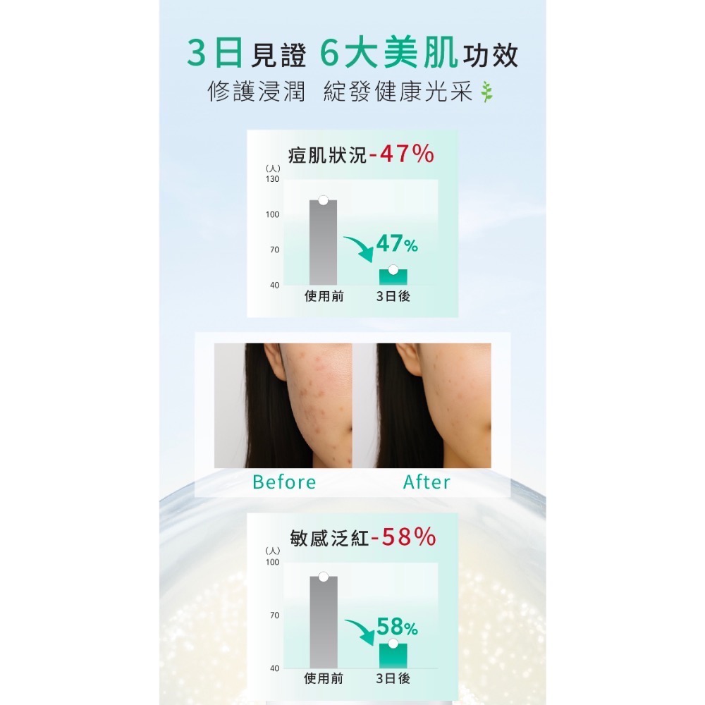 ALBION 健康化妝水 27ml、噴霧、面膜、洗顏皂-細節圖3