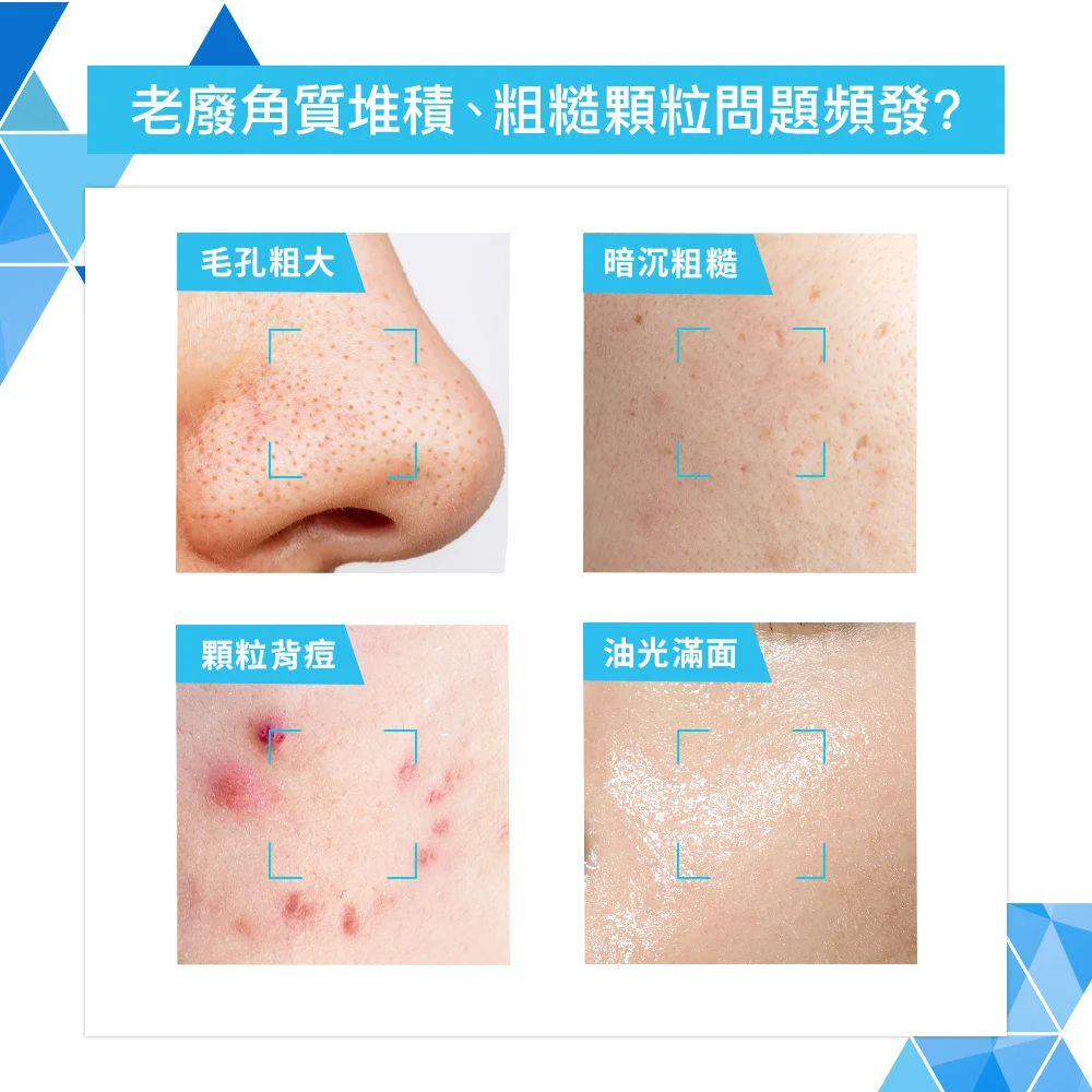 【藥局直營】CeraVe 適樂膚-水楊酸煥膚淨嫩潔膚露 473 ml  |水楊酸|(買即隨機贈適樂膚小樣) 大昕藥局-細節圖3
