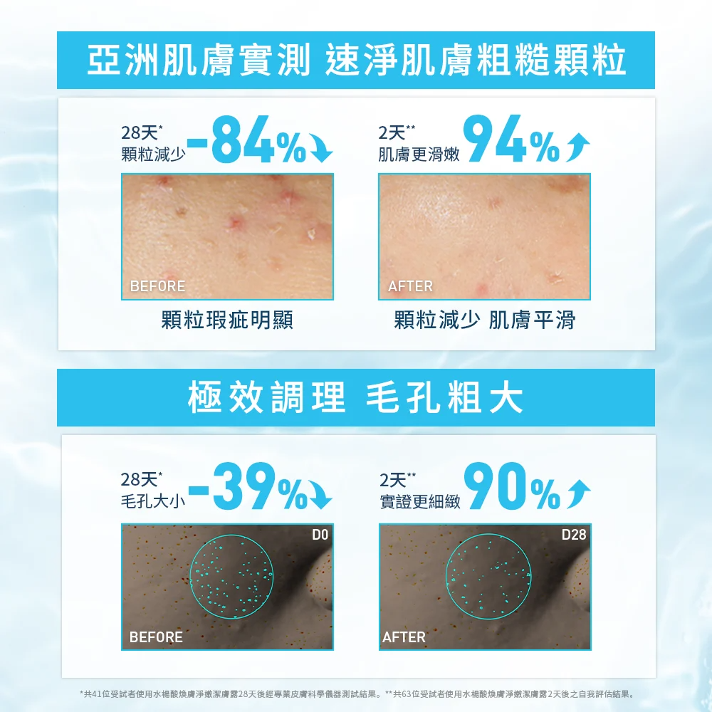 【藥局直營】CeraVe 適樂膚-水楊酸煥膚淨嫩潔膚露 473 ml  |水楊酸|(買即隨機贈適樂膚小樣) 大昕藥局-細節圖4