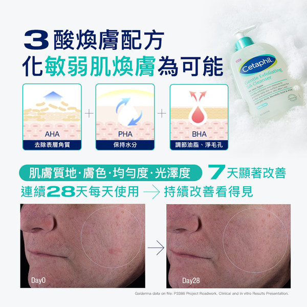 【藥局直營】Cetaphil 舒特膚 三酸煥膚嫩亮潔膚露473ml |杏仁酸 |水楊酸 |葡萄糖酸 大昕藥局-細節圖5