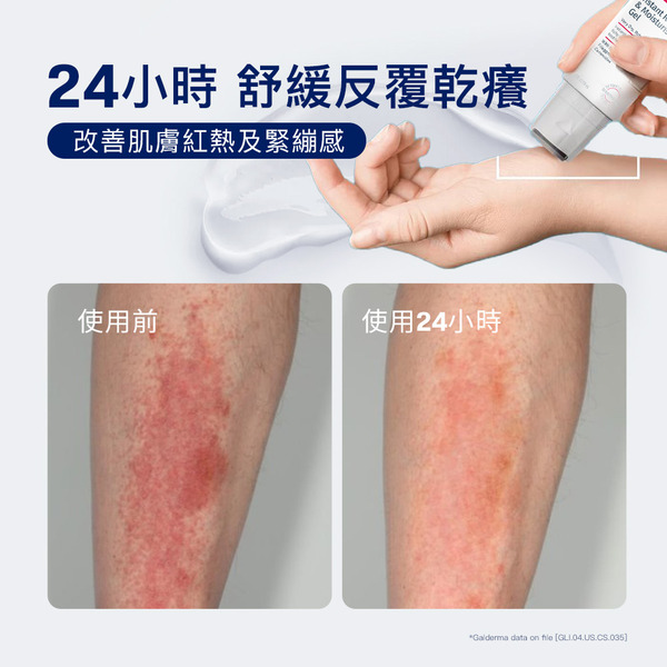 【藥局直營】舒特膚 AD益膚康瞬效舒敏凝膠 59ml  大昕藥局-細節圖7