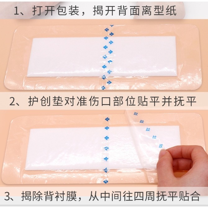 剖腹產 大傷口 專用 無菌敷料 傷口防水貼-細節圖7