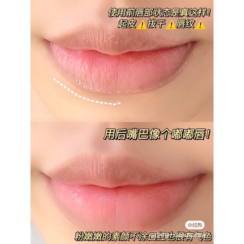 現貨✨正品授權  AMORTALS 爾木萄 巨無霸 護唇膏💕奶香椰子味🥥 潤唇膏9g 唇膏 爾木萄 護唇膏 巨大 葡-細節圖5