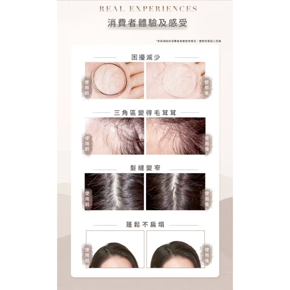 【THE VITA】頭皮調理液 110ml 頭皮調理 頭皮護理 護髮 頭皮水 蓬鬆 修復-細節圖3