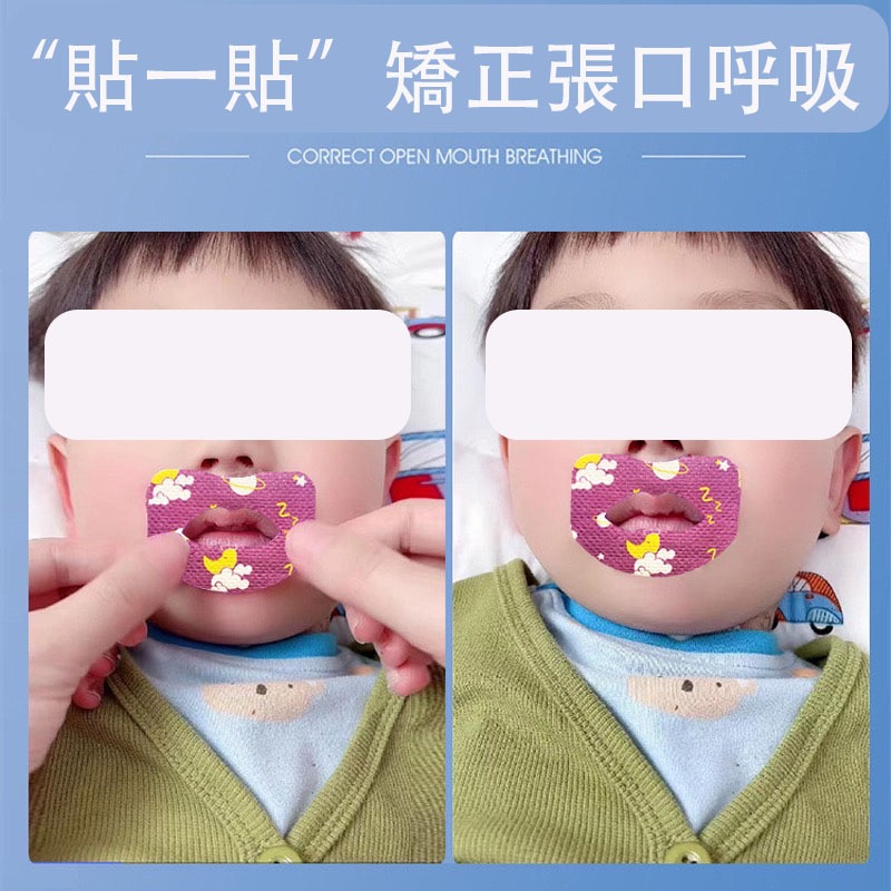呼吸矯正貼 防張嘴口貼 嘴貼 睡眠嘴貼 口呼吸貼 唇貼 止鼾貼 成人兒童防止打鼾 矯正張口貼 止鼾-細節圖6